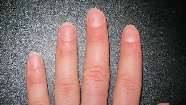 Added Benefit of Healthy Nails