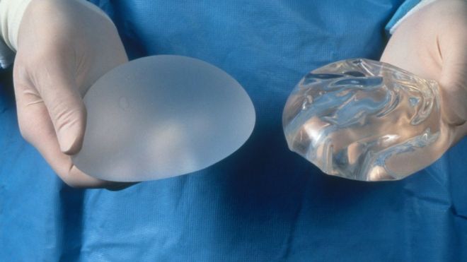 What They Don’t Tell You About Breast Implant Complications
