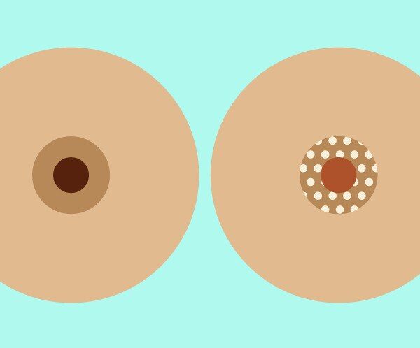 why are my areolas big